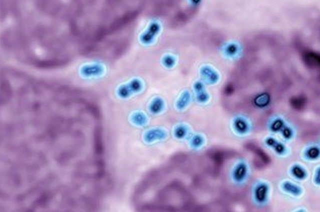 Descubren una “super gonorrea”, sería resistente a los antibióticos