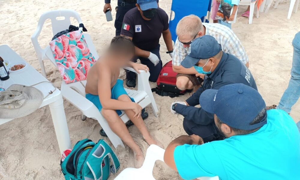 Reportan 17 ataques de mantarrayas en Progreso